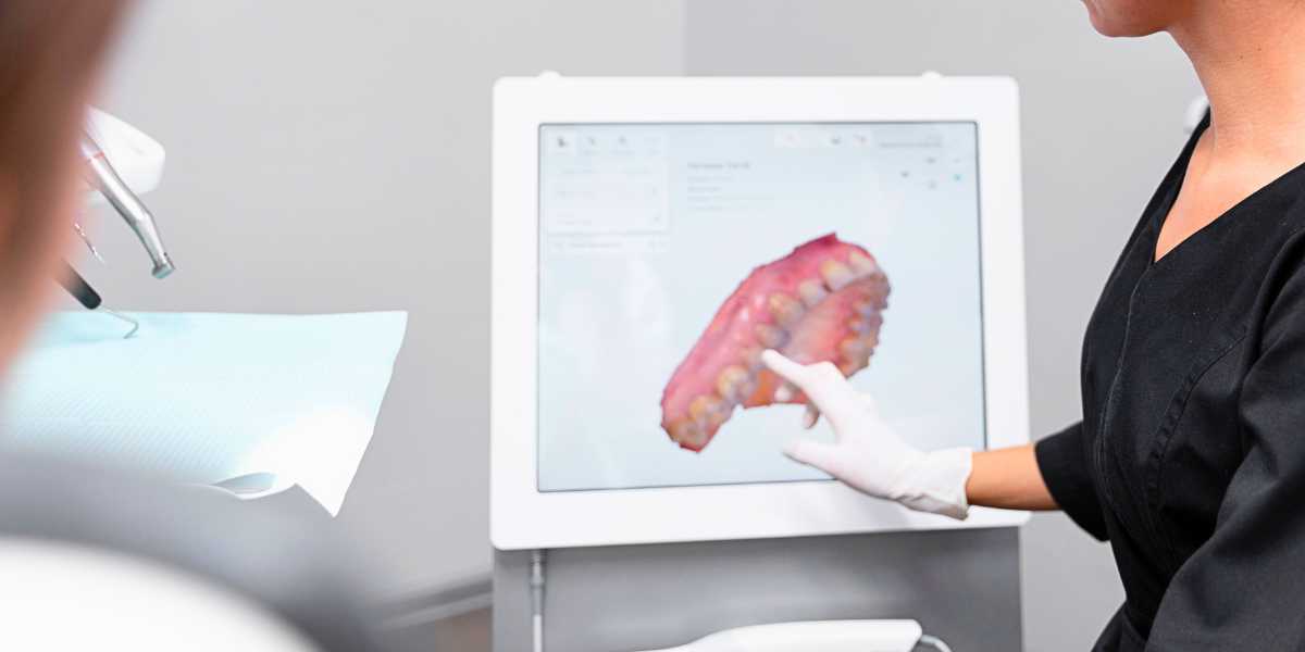 Escaneamento intraoral 3D