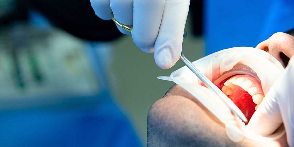 Cirurgia Bucomaxilofacial
