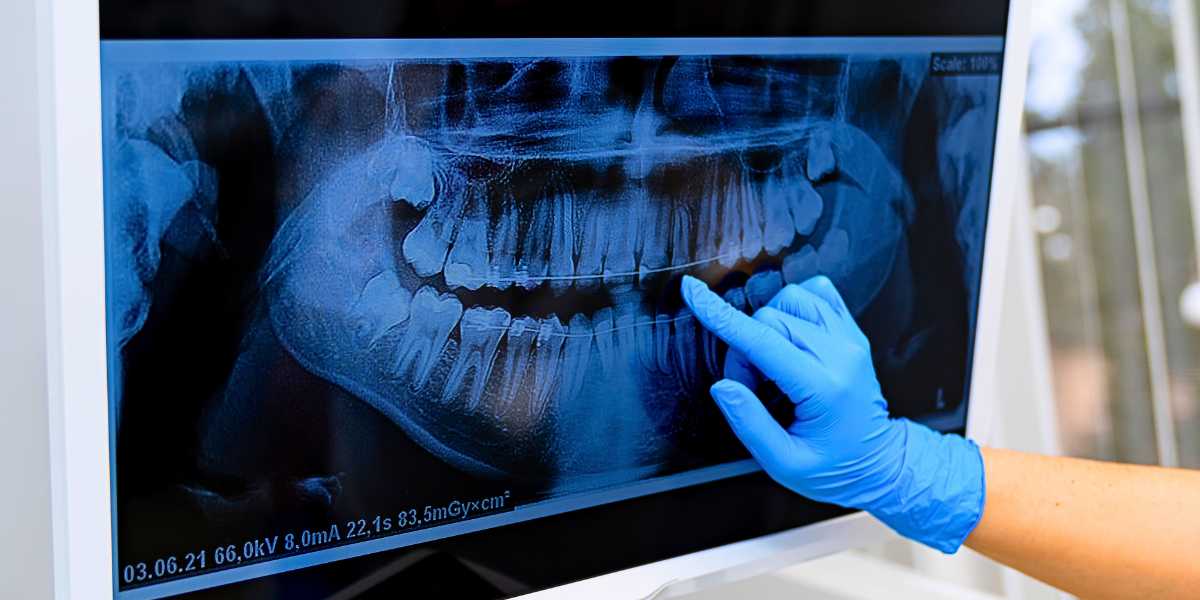 Radiografias e tomografias digitais