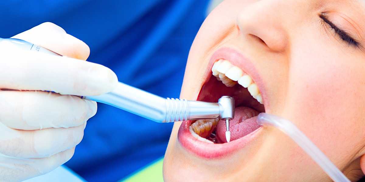 Raspagem e alisamento radicular