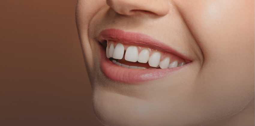 Como Funciona o Fechamento de Diastema com Resina