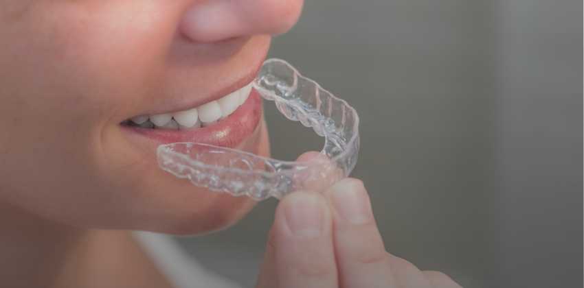 O que é Ortodontia Preventiva e para que serve? Entenda!