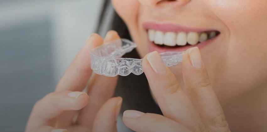 Tipos de Aparelhos Ortodônticos: conheça as opções para alinhar seu sorriso