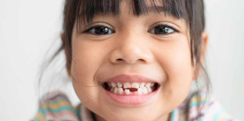 Dentes de Leite: Por Que Eles São Mais Importantes do Que Você Imagina?