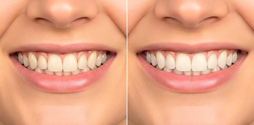 Transformação com Propósito: O Sorriso como Chave para uma Nova Vida